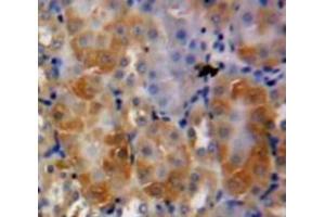 Used in DAB staining on fromalin fixed paraffin-embedded Kidney tissue (Midkine Antikörper  (AA 22-143))
