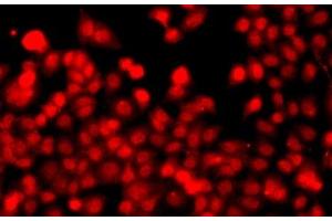 Immunofluorescence analysis of A549 cells using THAP1 Polyclonal Antibody (THAP1 Antikörper)