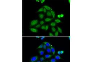 Immunofluorescence analysis of MCF7 cells using ELAC2 Polyclonal Antibody (ELAC2 Antikörper)