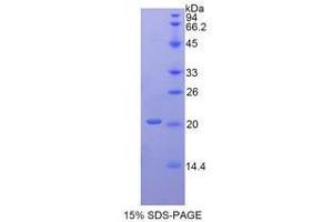 SDS-PAGE analysis of Human ACP3 Protein. (ACPP Protein)
