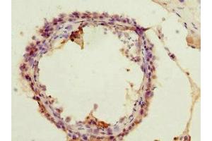 Immunohistochemistry of paraffin-embedded human testis tissue using ABIN7142950 at dilution of 1:100 (ACSS2 Antikörper  (AA 462-701))