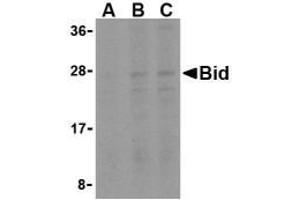 Western blot analysis of Bid in A549 cell lysates with Bid AP30148PU-N antibody at (A) 0. (BID Antikörper  (Middle Region))