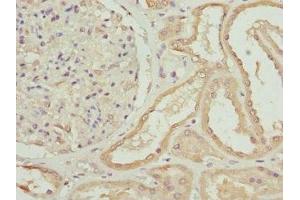 Immunohistochemistry of paraffin-embedded human kidney tissue using ABIN7176187 at dilution of 1:100 (ZNF24 Antikörper  (AA 169-368))