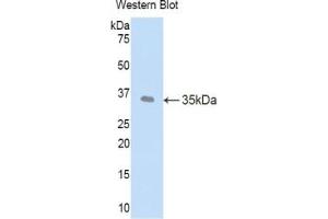 Detection of Recombinant LEFTY1, Human using Polyclonal Antibody to Left/Right Determination Factor 1 (LEFTY1) (LEFTY1 Antikörper  (AA 78-361))