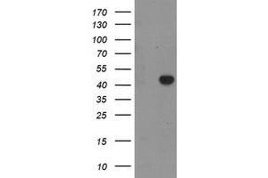 Western Blotting (WB) image for anti-RAB3A Interacting Protein (Rabin3)-Like 1 (RAB3IL1) antibody (ABIN1498513)