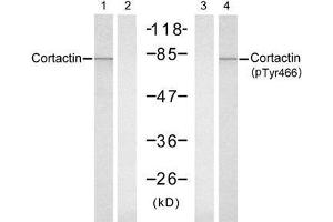 Western blot analysis of extracts from Hela cells, untreated or treated with UV (20min), using Cortactin (Ab-466) antibody (E021264, Lane 1 and 2) and Cortactin (Phospho-Tyr466) antibody (E011272, Lane 3 and 4). (Cortactin Antikörper)
