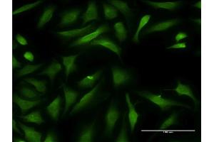 Immunofluorescence of monoclonal antibody to CCBL1 on HeLa cell. (CCBL1 Antikörper  (AA 1-374))