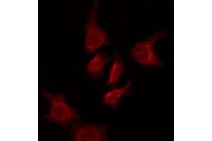ABIN6276096 staining HuvEc by IF/ICC. (OR5AK3P Antikörper)