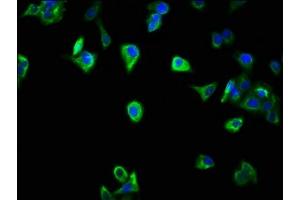 Immunofluorescence staining of HepG2 cells with ABIN7169521 at 1:266, counter-stained with DAPI. (SCOC Antikörper  (AA 1-121))