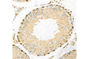 Immunohistochemistry of paraffin embedded rat testis using CUX2 (ABIN7073607) at dilution of 1:700 (300x lens) (CUX2 Antikörper)