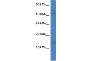 Image no. 1 for anti-Chemokine (C-C Motif) Ligand 16 (CCL16) (AA 9-58) antibody (ABIN6746018) (CCL16 Antikörper  (AA 9-58))