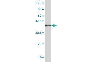 Western Blot detection against Immunogen (37. (Pleiotrophin Antikörper  (AA 45-154))