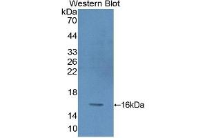 Detection of Recombinant PKIg, Human using Polyclonal Antibody to Protein Kinase Inhibitor Gamma (PKIg) (PKIG Antikörper  (AA 1-76))