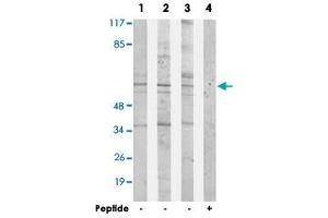 Western blot analysis of extracts from 293 cells (Lane 1), HepG2 cells (Lane 2) and Jurkat cells (Lane 3 and lane 4), using ACRBP polyclonal antibody .