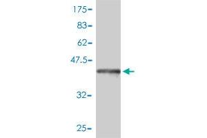 Western Blotting (WB) image for anti-Catechol-O-Methyltransferase (COMT) (AA 1-182) antibody (ABIN560435)
