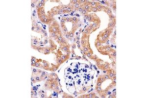 Paraformaldehyde-fixed, paraffin embedded mouse kidney tissue, Antigen retrieval by boiling in sodium citrate buffer (pH6. (RPS6 Antikörper)