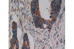 IHC-P analysis of Human Tissue, with DAB staining. (IL17RD Antikörper  (AA 157-299))