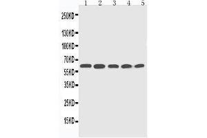 Anti-CYP2U1 antibody, Western blotting Lane 1: HELA Cell Lysate Lane 2: MCF-7 Cell Lysate Lane 3: MM453 Cell Lysate Lane 4: COLO320 Cell Lysate Lane 5:  Cell Lysate (CYP2U1 Antikörper  (C-Term))