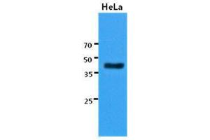 The cell lysates of HeLa (30 ug) were resolved by SDS-PAGE, transferred to PVDF membrane and probed with KRT23 antibody (1:3000). (KRT23 Antikörper  (AA 271-422))