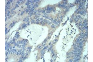 Immunohistochemistry (IHC) image for anti-Methyl CpG Binding Protein 2 (MECP2) (AA 7-148) antibody (ABIN5542475)