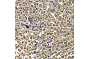 Immunohistochemistry of paraffin-embedded mouse cancer using ARID3A antibody. (ARID3A Antikörper)