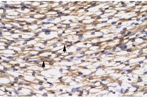 Rabbit Anti-CCL7 Antibody  Paraffin Embedded Tissue: Human Heart Cellular Data: Myocardial cells Antibody Concentration: 4. (CCL7 Antikörper  (N-Term))