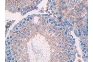 Immunohistochemistry (IHC) image for anti-Ubiquitin D (UBD) (AA 1-155) antibody (ABIN7442102)