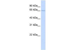 WB Suggested Anti-TKTL2 Antibody Titration:  0. (TKTL2 Antikörper  (N-Term))
