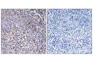 Immunohistochemistry analysis of paraffin-embedded human tonsil tissue using Cytochrome c-type Heme Lyase antibody. (HCCS Antikörper  (Internal Region))