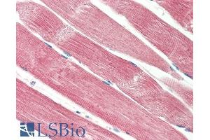 ABIN5539898 (5µg/ml) staining of paraffin embedded Human Skeletal Muscle. (THNSL2 Antikörper  (Internal Region))
