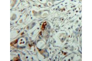 Used in DAB staining on fromalin fixed paraffin-embedded pancreas tissue (NEU1 Antikörper  (AA 141-286))