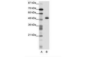 Image no. 1 for anti-Zinc Finger Protein 213 (ZNF213) (N-Term) antibody (ABIN202568) (ZNF213 Antikörper  (N-Term))