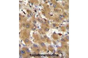 Immunohistochemistry (IHC) image for anti-Haptoglobin Related Protein (HPR) antibody (ABIN2996022) (HPR Antikörper)