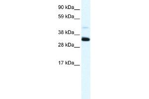 WB Suggested Anti-ANXA3 Antibody Titration:  1. (Annexin A3 Antikörper  (N-Term))