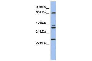 ATP6V1A antibody used at 1 ug/ml to detect target protein. (ATP6V1A Antikörper  (N-Term))
