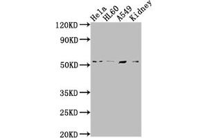 Western Blot Positive WB detected in: Hela whole cell lysate, HL60 whole cell lysate, A549 whole cell lysate, Mouse kidney tissue All lanes: ILK antibody at 1:2000 Secondary Goat polyclonal to rabbit IgG at 1/50000 dilution Predicted band size: 52, 45, 37 kDa Observed band size: 51 kDa (Rekombinanter ILK Antikörper)