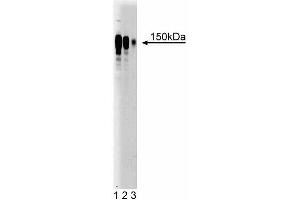 Western blot analysis of Ataxin-2 on Jurkat cell lysate (left). (Ataxin 2 Antikörper  (AA 713-904))