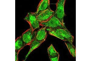 Immunofluorescence (IF) image for anti-Bone Morphogenetic Protein 4 (BMP4) (AA 277-408) antibody (ABIN5542285)