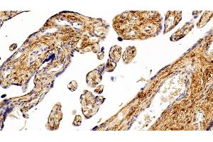 Immunohistochemistry (IHC) image for anti-S100 Calcium Binding Protein A6 (S100A6) (AA 1-90) antibody (ABIN7434041)