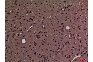 Immunohistochemistry (IHC) analysis of paraffin-embedded Rat Brain, antibody was diluted at 1:100.