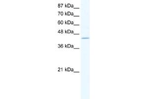 WB Suggested Anti-ZNF212 Antibody Titration:  1. (ZNF212 Antikörper  (C-Term))