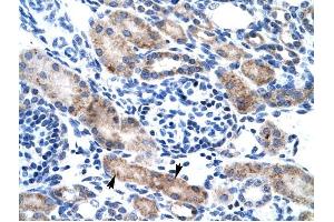 CLIC1 antibody was used for immunohistochemistry at a concentration of 4-8 ug/ml to stain Epithelial cells of renal tubule (arrows) in Human Kidney.
