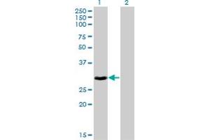 Western Blot analysis of HOXB9 expression in transfected 293T cell line by HOXB9 monoclonal antibody (M10), clone 2F8. (HOXB9 Antikörper  (AA 1-98))
