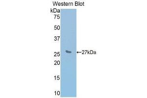Western Blotting (WB) image for anti-Interleukin 2 Receptor, beta (IL2RB) (AA 27-240) antibody (ABIN1859416) (IL2 Receptor beta Antikörper  (AA 27-240))