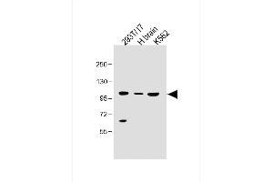 Solute Carrier Family 14 (Urea Transporter, Kidney) Member 2 (SLC14A2) (AA 42-76) anticorps