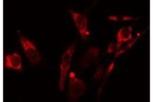 ABIN6278264 staining NIH-3T3  cells by IF/ICC. (LGALS8 Antikörper  (Internal Region))