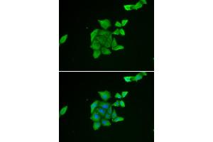 Immunofluorescence analysis of U2OS cell using TUSC2 antibody. (TUSC2 Antikörper)