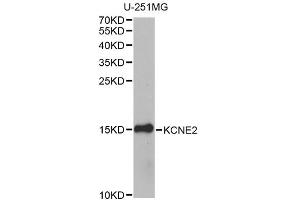 Western blot analysis of extracts of U-251MG cells, using KCNE2 antibody.