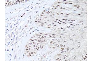 Immunohistochemistry of paraffin-embedded human skin using TP63 antibody (ABIN5971164) at dilution of 1:50 (40x lens). (p63 Antikörper)