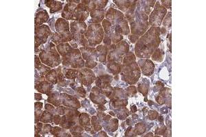 Immunohistochemical staining of human pancreas with KIAA1143 polyclonal antibody  shows strong cytoplasmic positivity in exocrine glandular cells at 1:1000-1:2500 dilution.
